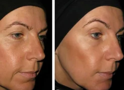 Vitame Collagen Plus