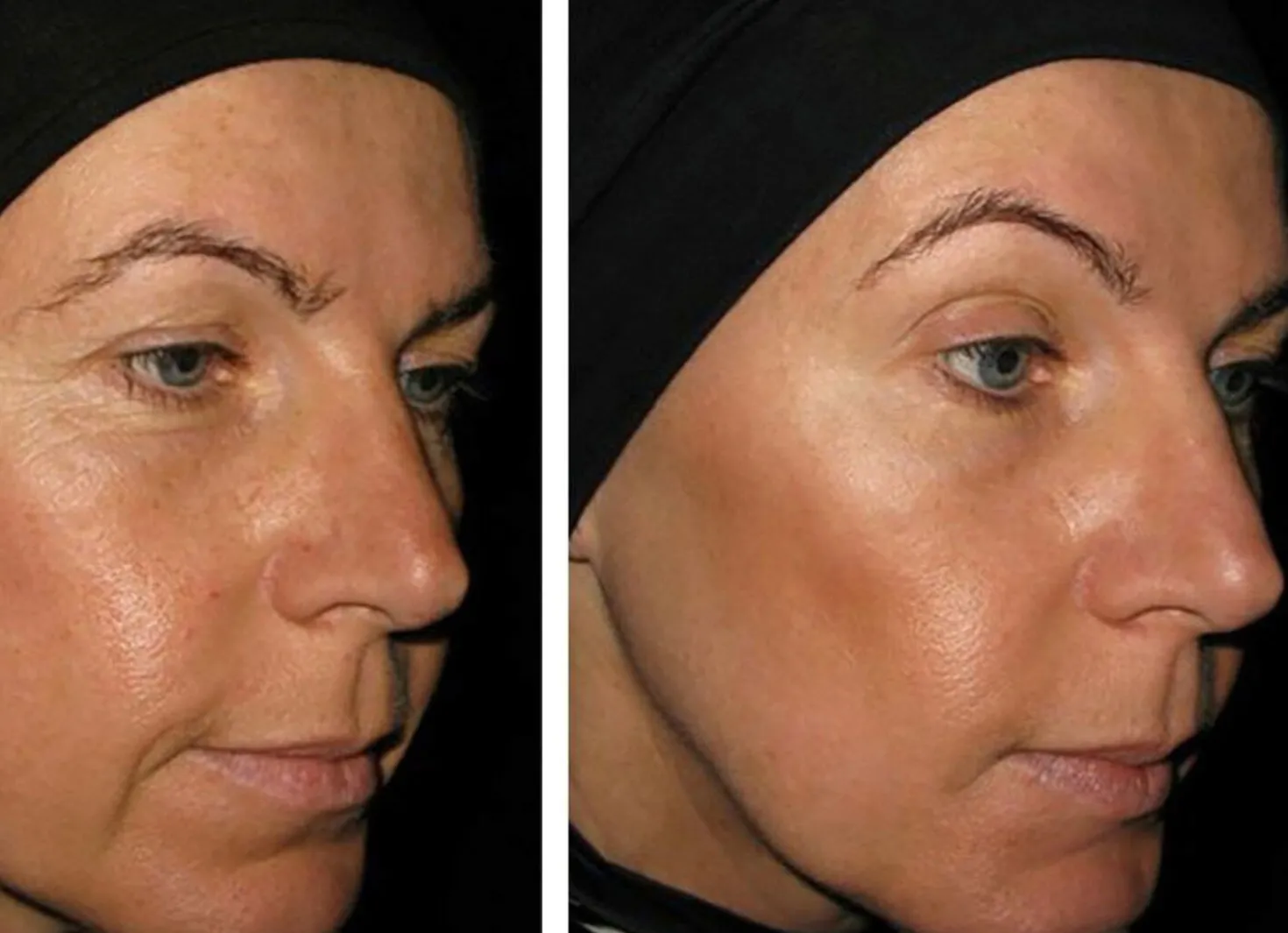Vitame Collagen Plus