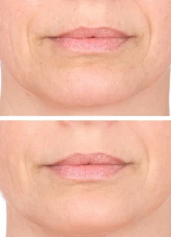 Vitame Collagen Plus