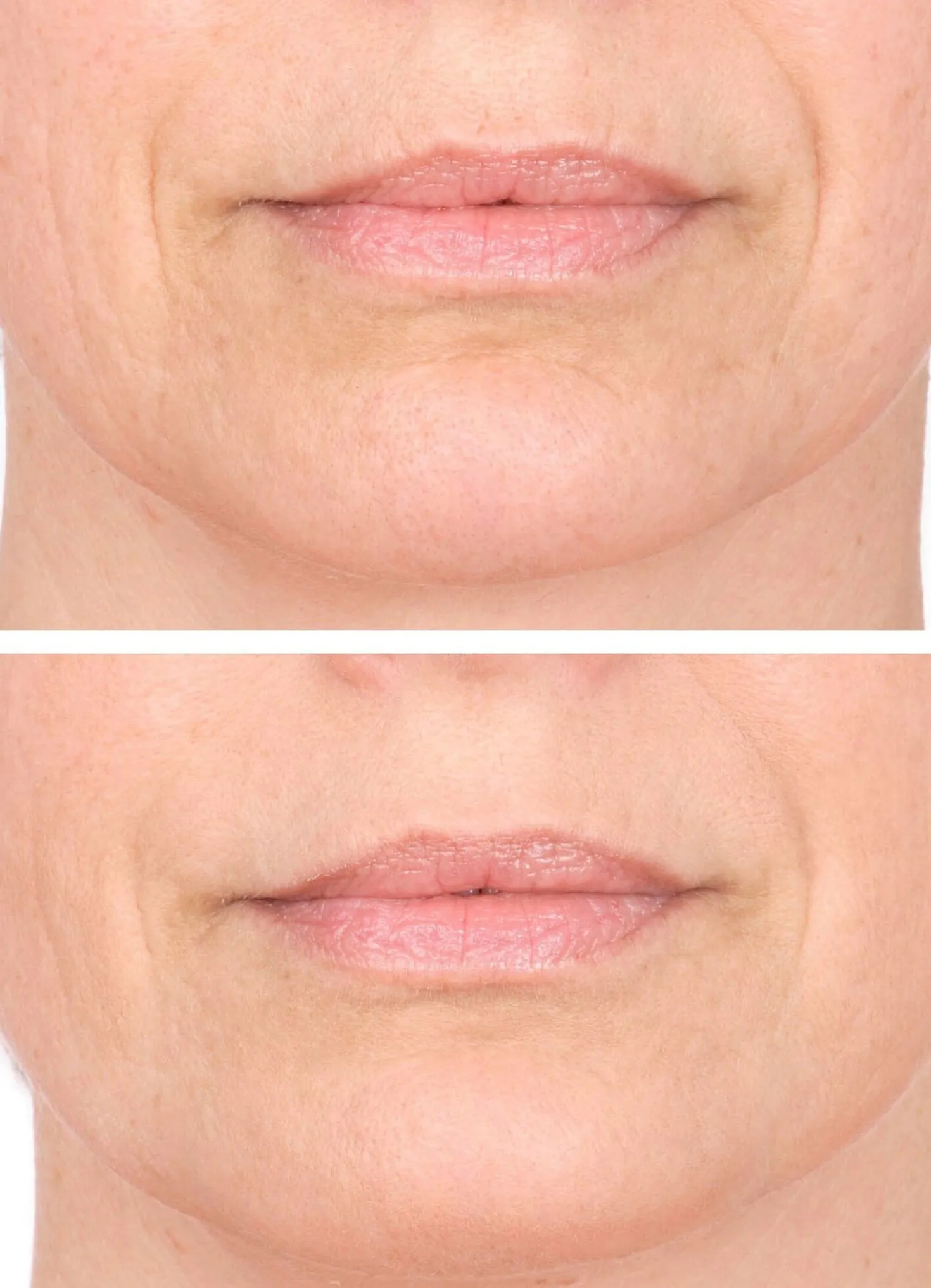 Vitame Collagen Plus